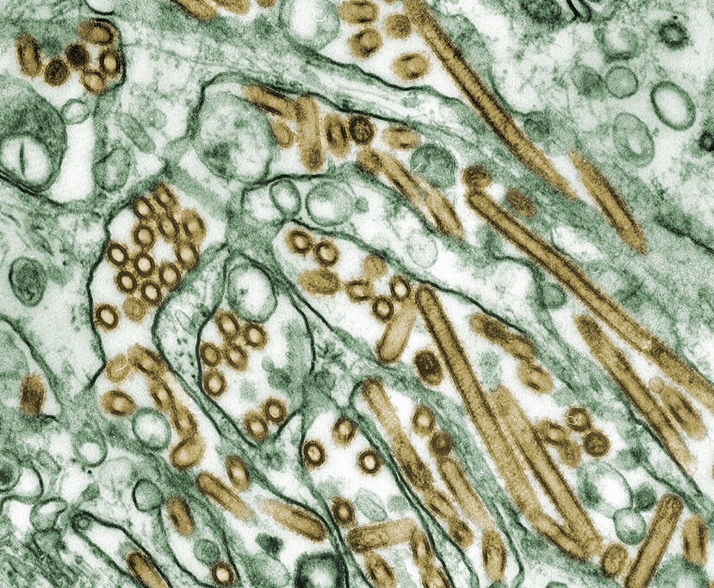 Image: CDC/ Courtesy of Cynthia Goldsmith; Jacqueline Katz; Sherif R. Zaki