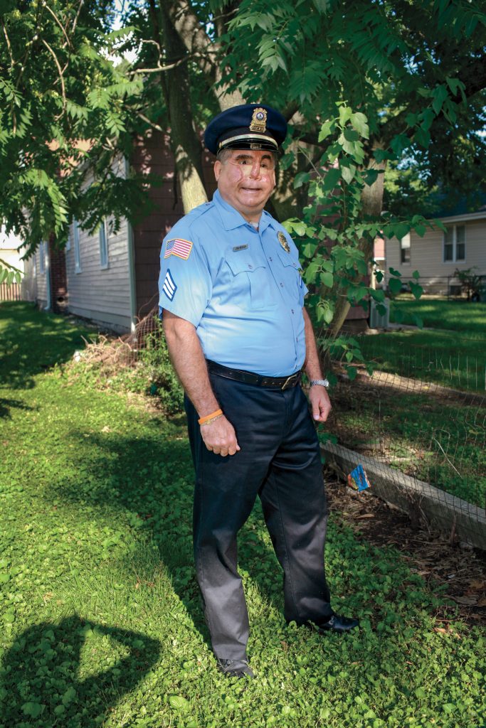 Police sergeant Jon Brough was hit in the face by a wanted man who had just murdered two people. The sergeant’s face shield malfunctioned and he was blinded by the bullet. –Belleville, Illinois, 2006 Credit: SHOT: 101 Survivors of Gun Violence in America by Kathy Shorr, published by powerHouse Books