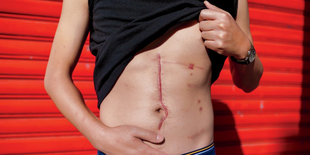 Antonius Wiriadjaja was struck by a random bullet as he walked down a crowded Brooklyn street in 2013. The intended target...