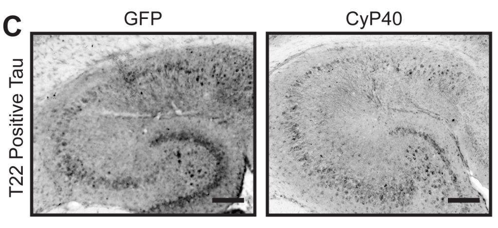 Gene therapy that increases the levels of an enzyme called CyP40 can reduce toxic tangles of tau protein in a mouse model ...