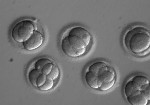 This image shows early embryos two days after co-injection with a gene editing technology called CRISPR. A new study shows by editing at the time of fertilization, each new cell in the developing embryos was uniformly free of a heart disease-causing mutation. Photo by Oregon Health & Science University
