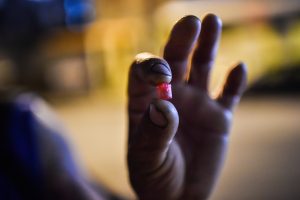 PHILADELPHIA, PA - JULY 20: Art Gutierrez, 42, holds an orange container, "trash can," filled with heroin powder, that he bought on Thursday, July 20, 2017, in Philadelphia, PA. Gutierrez who grew up in California, has been using heroin for two year and during that these two years he has contracted HIV and Hep C. (Photo by Salwan Georges/The Washington Post via Getty Images)