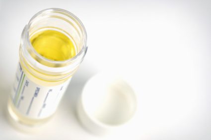 Urine screens cost $8.5 billion a year — more than the entire EPA budget