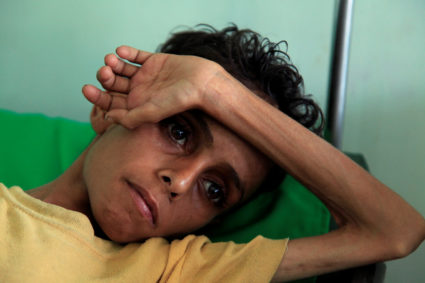 AP report: Yemen's food donations are being snatched from the starving
