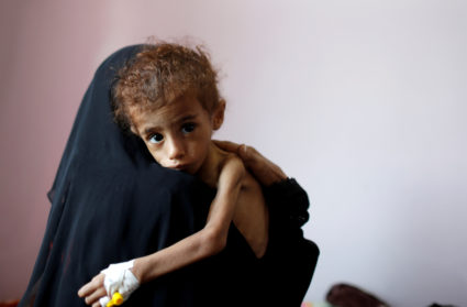 Fighting, starvation and disease yield grim crisis in Yemen