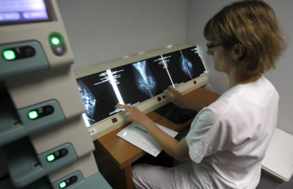 A radiologist examines breast X-rays after a cancer prevention medical check-up at the Ambroise Pare hospital in Marseille, southern France, on April 3, 2008. Photo by Jean-Paul Pelissier/REUTERS