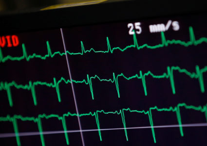 For 1st time in 4 years, U.S. life expectancy rises, but only a little