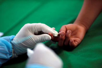 Remote region of Brazil's Amazon experiences first deaths by coronavirus