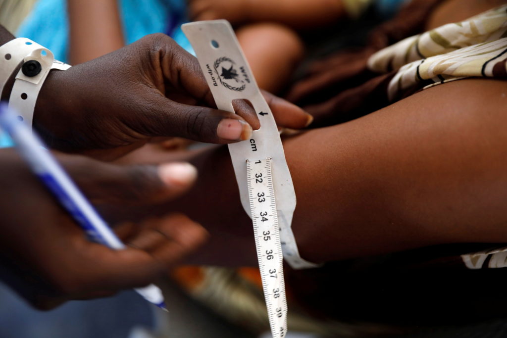 An aid worker measures the arm diameter of an Ethiopian asylum seeker at a nutrition clinic at the Um Rakuba refugee camp ...