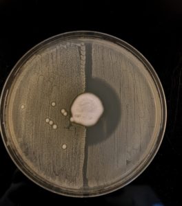 Fungus and bacteria. Credit Claire L. Raisen