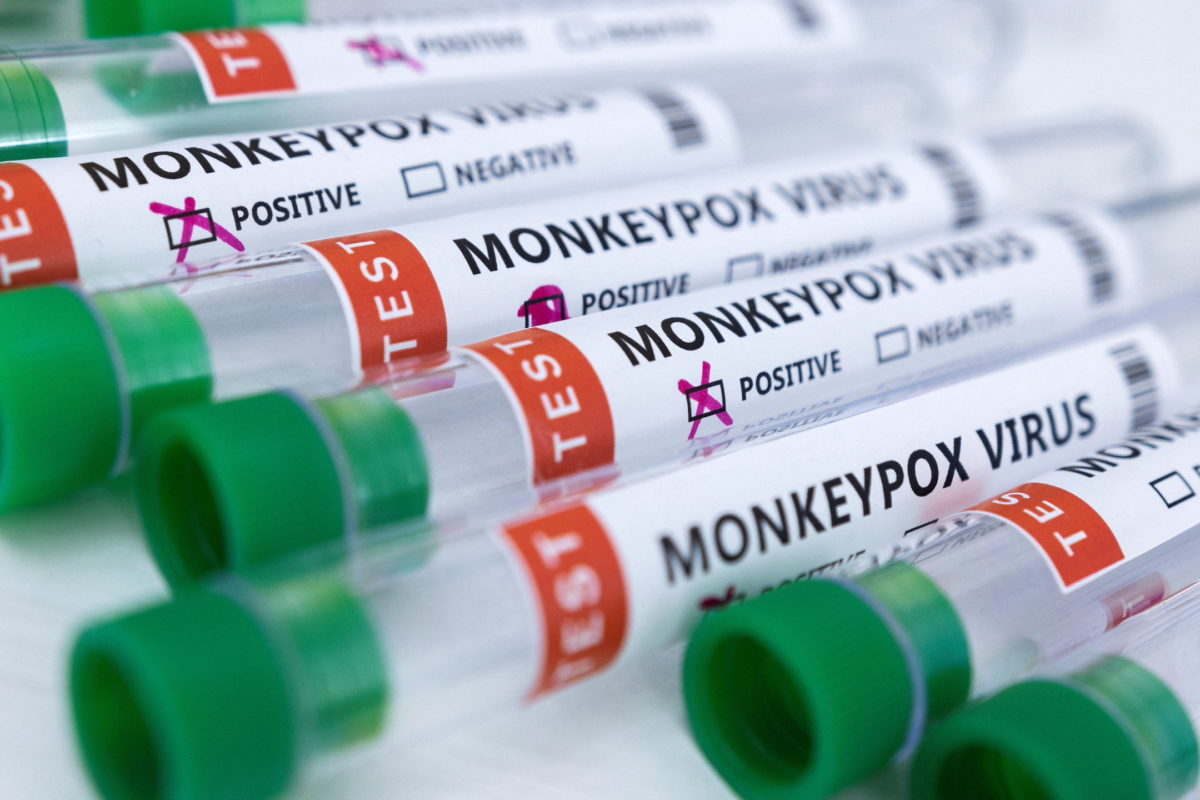 WHO calls monkeypox outbreaks containable, proposes stockpile to share ...
