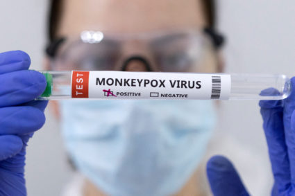 FILE PHOTO: Illustration shows test tubes labelled "Monkeypox virus positive