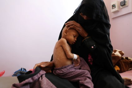 Yemeni children starve as fears of renewed fighting loom