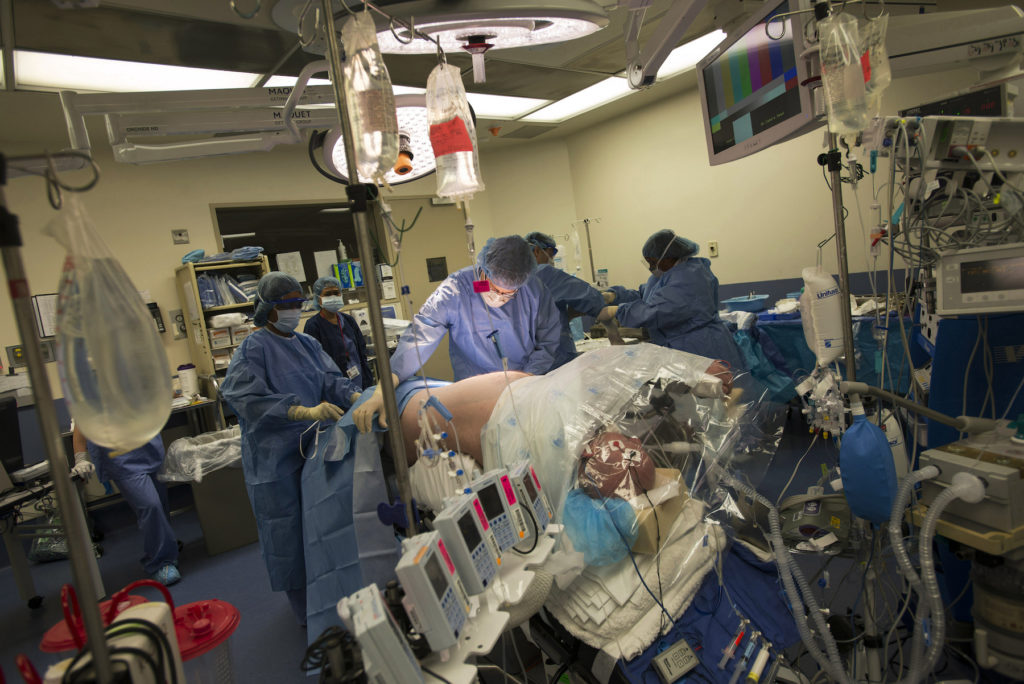Abernathy is prepared for surgery to receive donated kidney as part of a five-way organ transplant swap in New York