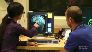 brainonart