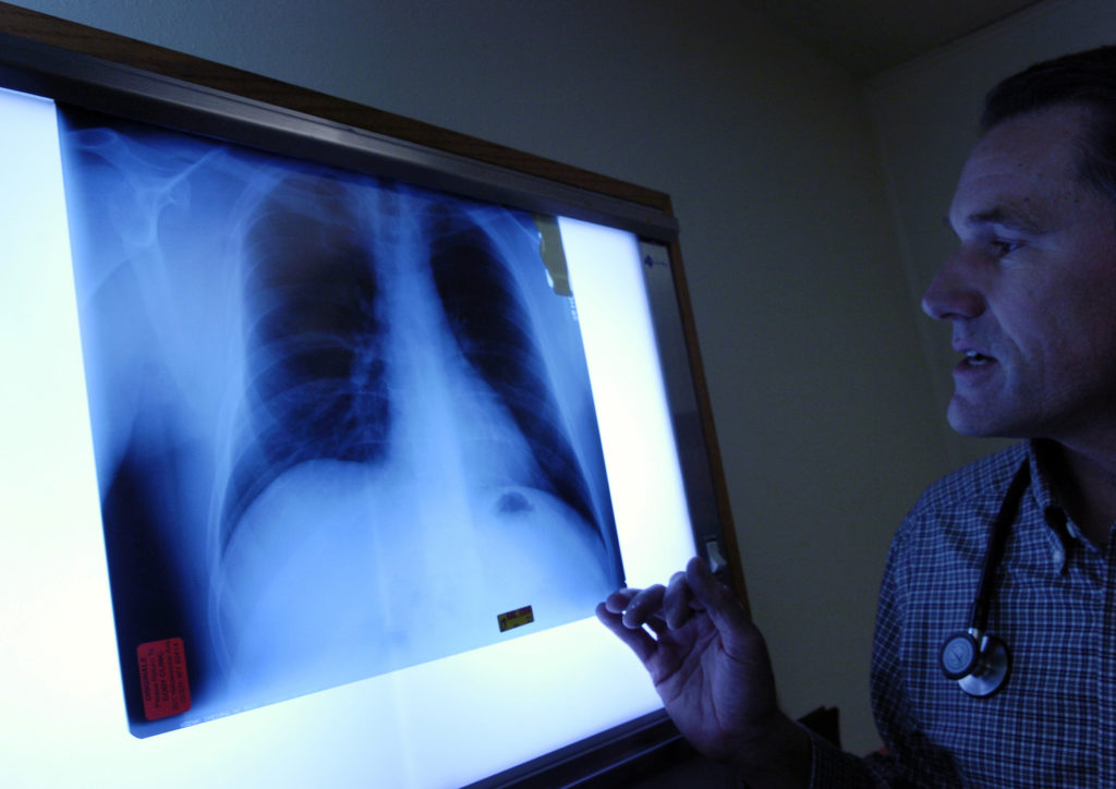 LIBBY, MT, (OCTOBER 07, 2006) -- Dr. Brad Black examined an x-ray in the Center for Asbestos Related Disease clinic in Lib...