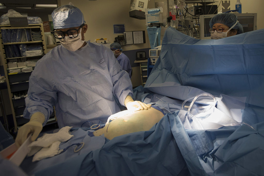 How America's organ transplant system can be improved