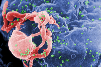 CDC image of HIV-1 virons budding from a cultured human lymphocytes