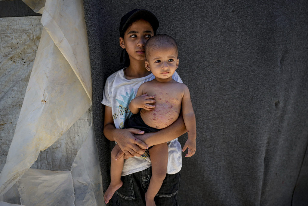 Israel Palestinians Skin Diseases