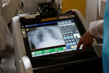 COVID-19 falls from No. 4 to No. 10 cause of death in U.S.