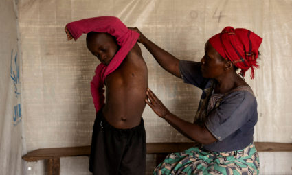 Children at risk as mpox variant hits Congo displacement camps