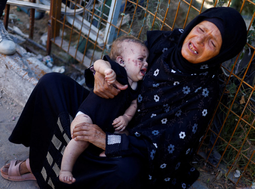 Gaza girl survives an Israeli strike that killed her entire family