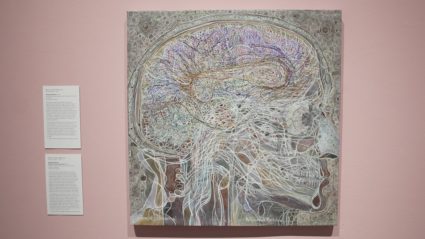brainart, memory loss, brain, art