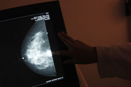 A monitor shows the image of a breast cancer at a centre run by the "Reto" Group for Full Recovery of Breast Cancer in Mex...