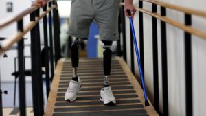costofprosthetics