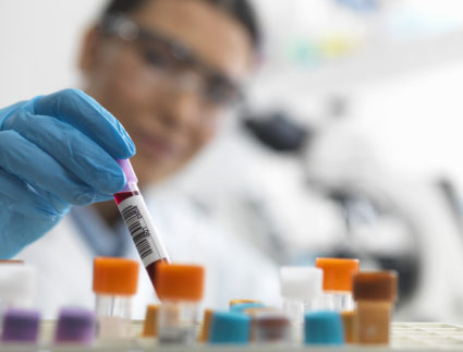 Female scientist about to view a human sample under a microscope