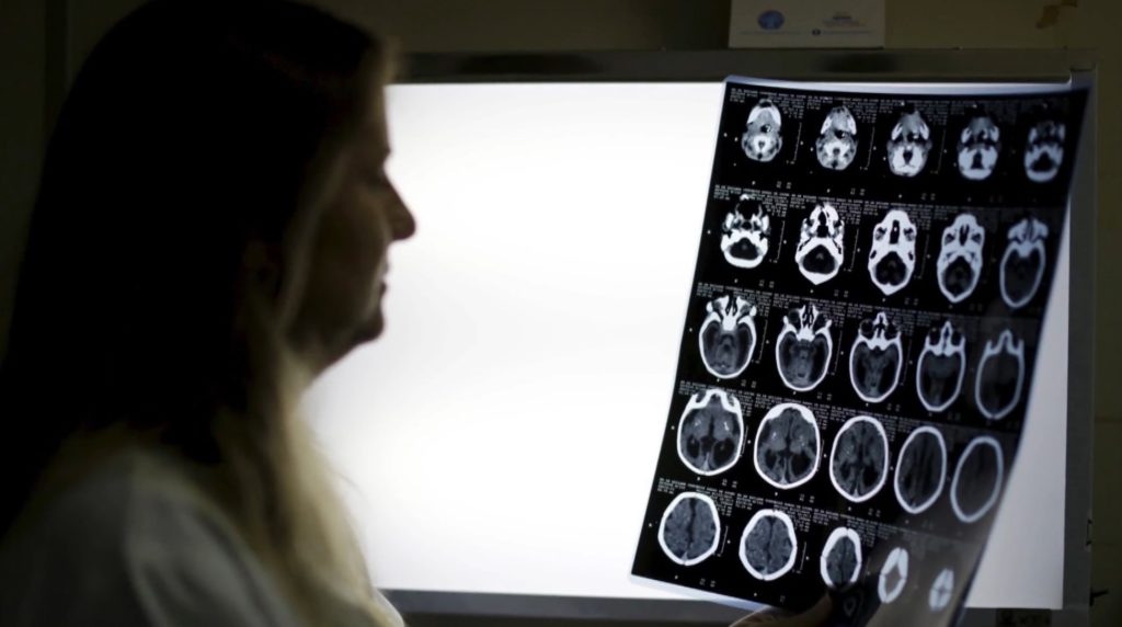 New study suggests link between medical imaging and pediatric cancer risk