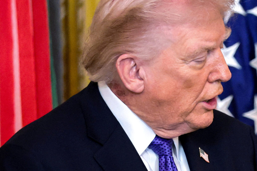 FILE PHOTO: A patch of blemished skin is visible on U.S. President Trump’s neck at the White House in Washington