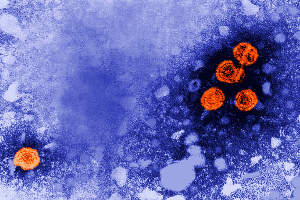 Hepatitis B