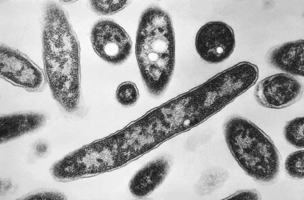 What to know about Legionnaires' disease making people sick in New York City