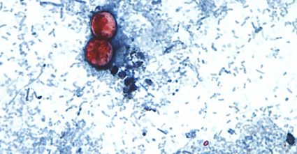 Cyclospora Outbreak