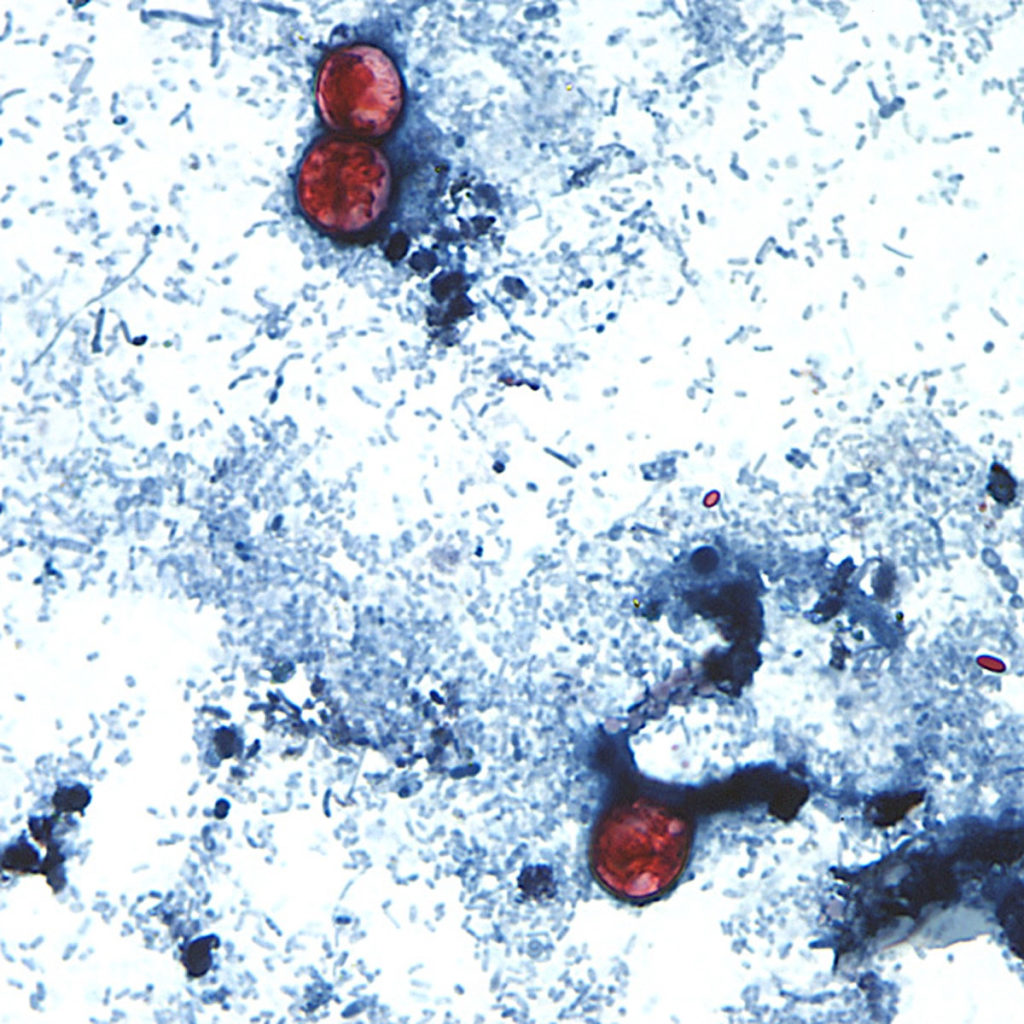 Cyclosporiasis cases in Michigan surpass 2,600, health officials say - image 1