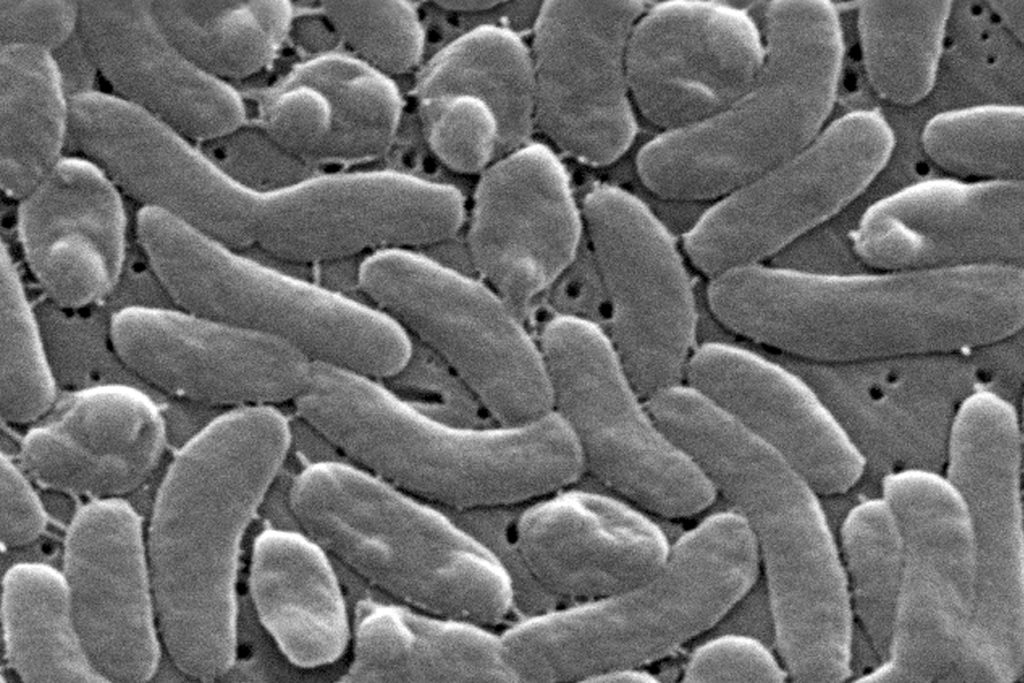 Deadly Bacteria Seawater